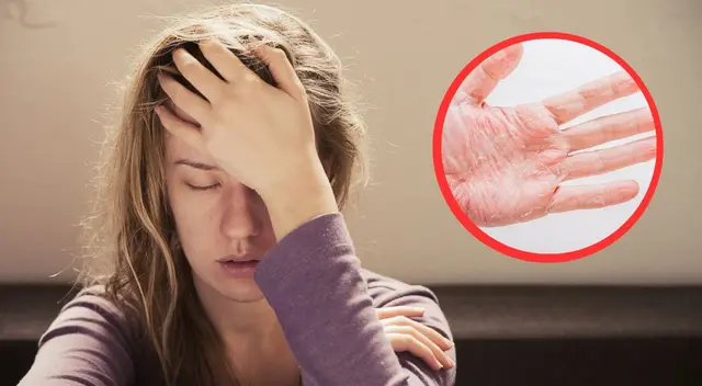 Existen varias razones por la cual una persona sufre con el estado de su piel.