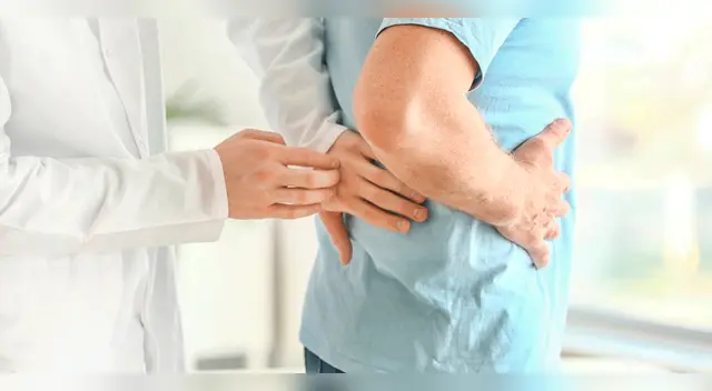 Estos alimentos podrían generarte cálculos renales.