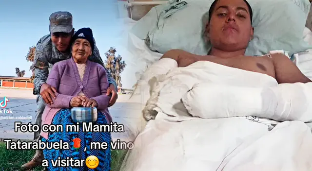 Los médicos del Hospital Arzobispo Loayza no tuvoeron otra opción que amputarle la mano. Los médicos del Hospital Arzobispo Loayza no tuvoeron otra opción que amputarle la mano.