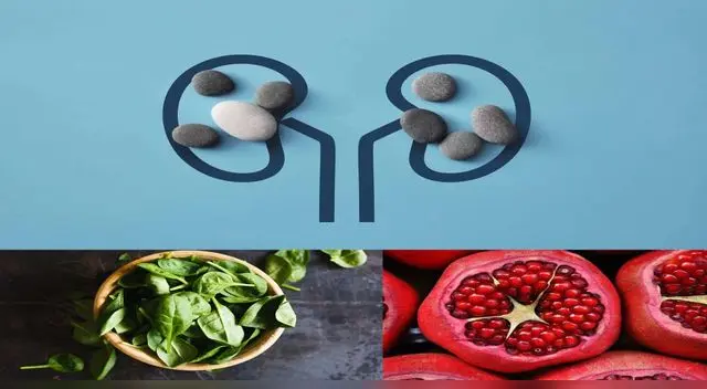 Alimentos que ayudan a eliminar las piedras de los riñones.