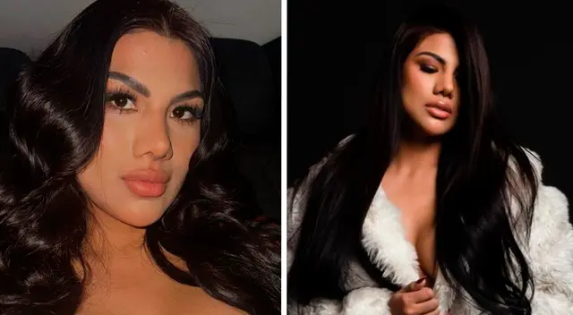 Brunella Horna reveló las cirugías que se realizó con el Doctor Fong.