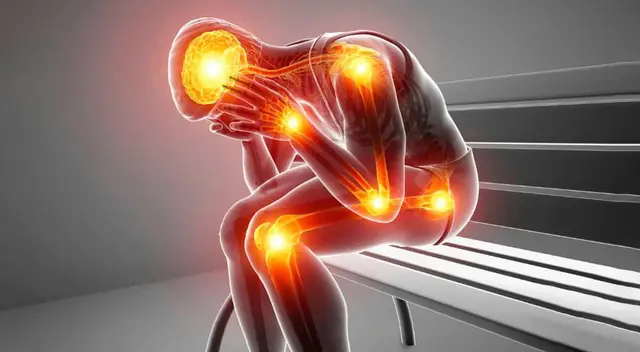 La fibromialgia: una enfermedad invisible que afecta a millones en Latinoamérica. La fibromialgia: una enfermedad invisible que afecta a millones en Latinoamérica.