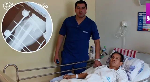 La exitosa operación logró que el trabajador de salud logre salvar su pierna.