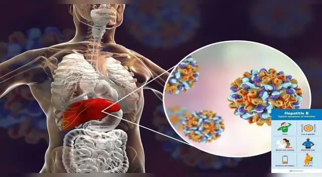 La hepatitis B es una infección transmisible.