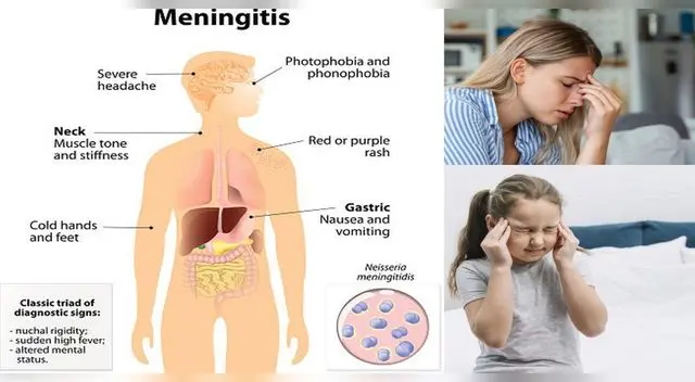 Hay que protegerse de la meningitis.