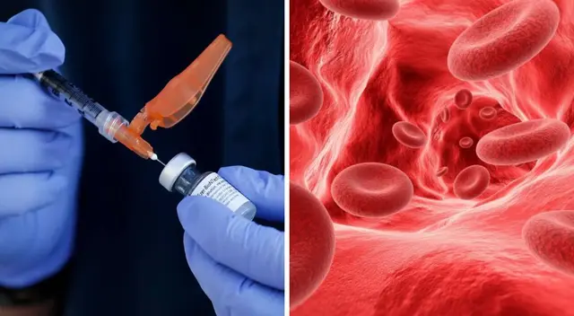 Tener niveles elevados de colesterol puede aumentar el riesgo de acumulación de placas en las arterias, según estudios médicos.