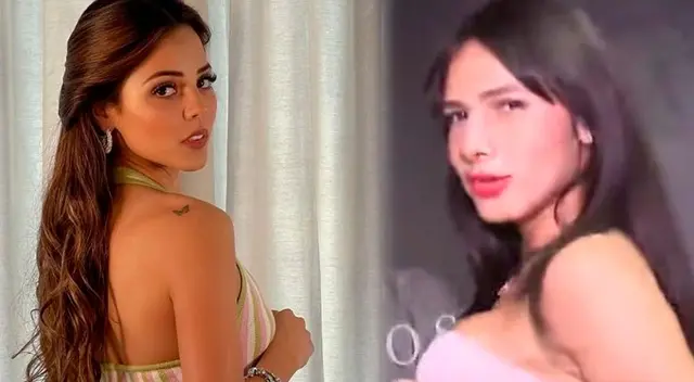 La Uchulú se realizó dos operaciones. La Uchulú se realizó dos operaciones.