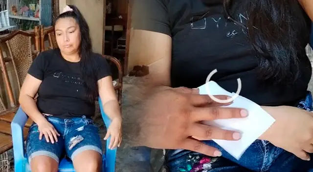 Mujer que suda sangre recibirá atención médica y tratamiento, en Loreto. Mujer que suda sangre recibirá atención médica y tratamiento, en Loreto.