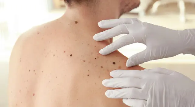 Pacientes de alto riesgo deben someterse a un examen completo anual, asegura especialista. Pacientes de alto riesgo deben someterse a un examen completo anual, asegura especialista.