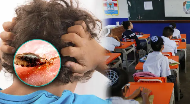 Escolares son más propensos a contagiarse de piojos en el colegio. Escolares son más propensos a contagiarse de piojos en el colegio.