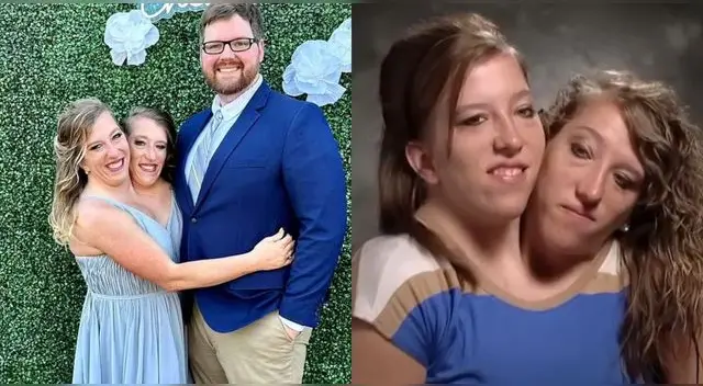Abby Hensel, una de las famosas gemelas siamesas, se casó en secreto en Estados Unidos.
