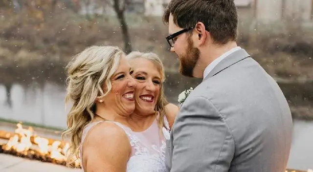 Las gemelas Abby y Brittany Hensel son siamesas conocidas. Las gemelas Abby y Brittany Hensel son siamesas conocidas.