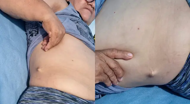 Mujer denunció a los médicos por mala praxis y su denuncia fue archivada. Mujer denunció a los médicos por mala praxis y su denuncia fue archivada.