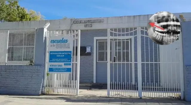 Niño de 12 años golpeó a su profesora y le fracturó la mandíbula en Argentina.