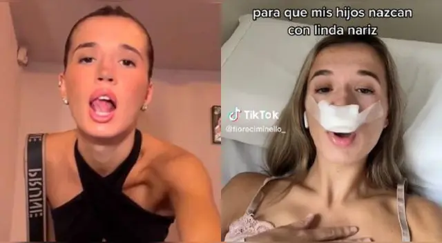 Joven se hace una rinoplastia para que sus hijos tengan una bella perfecta y es viral en TikTok.