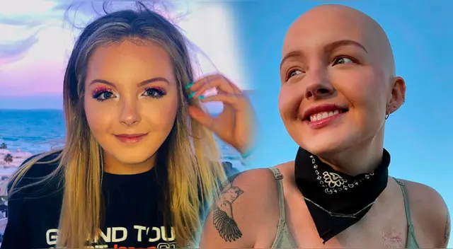 Maddy Baloy, reconocida influencer, era admirada por su resiliencia al padecer cáncer.