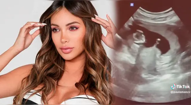 Paula Manzanal vuelve a salir embarazada luego de varios años.