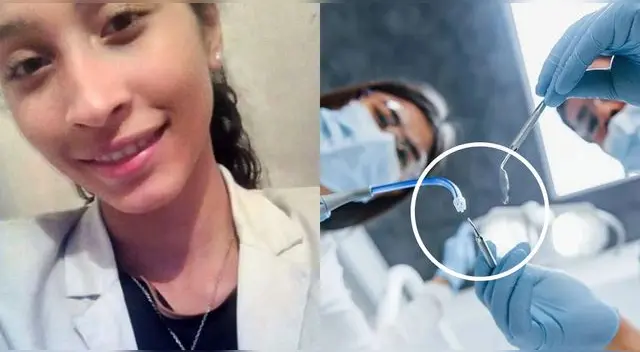Joven murió tras someterse a una cirugía de extracción de cordales en consultorio en Colombia.
