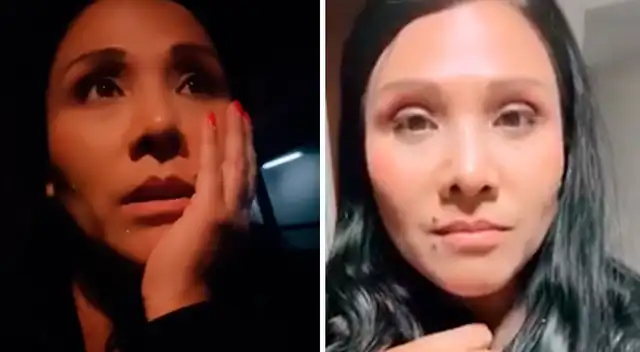 Tula Rodríguez sufrió terrible choque múltiple en la Vía Expresa: "Me salvó el cinturón"