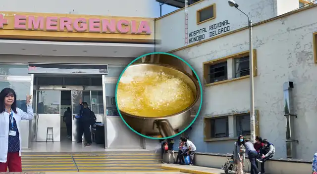 Mujer le lanzó aceite hirviendo a su hija dentro de su vivienda en Arequipa.