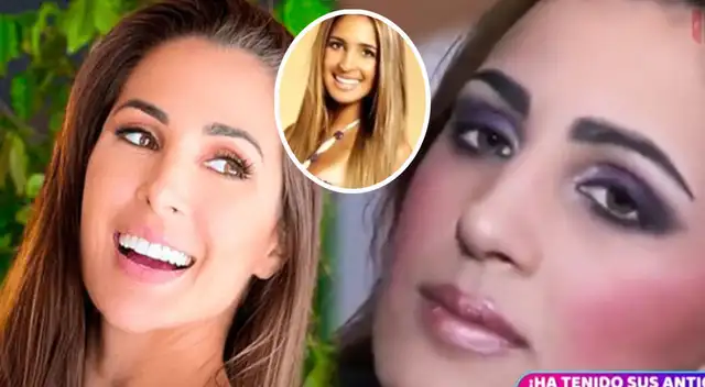 Este es el pasado de Ana Paula Consorte y Magaly Medina reacciona. Este es el pasado de Ana Paula Consorte y Magaly Medina reacciona.