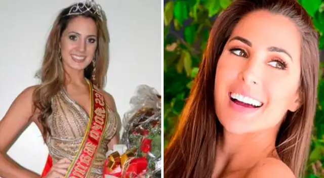 Cirujano estético evidencia cambio de look de Ana Paula Consorte: "Se hizo entre 12 a 15 cirugías"