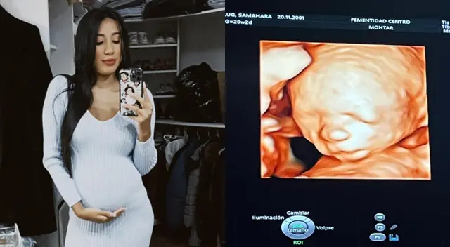 Samahara Lobatón está a la espera de su primera hija con Bryan Torres.