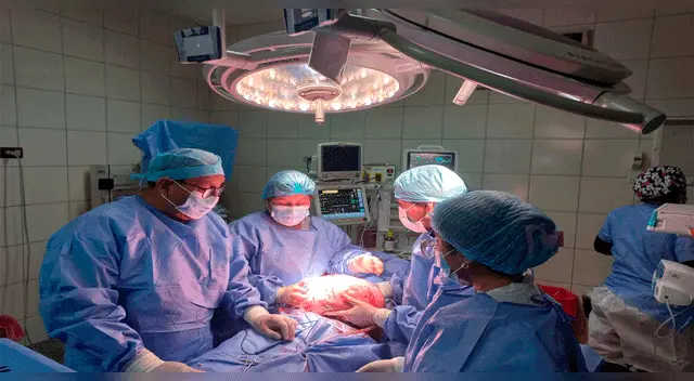 Médicos del Hospital Sergio Bernales de Collique extirparon el tumor y salvaron la vida de mujer Médicos del Hospital Sergio Bernales de Collique extirparon el tumor y salvaron la vida de mujer