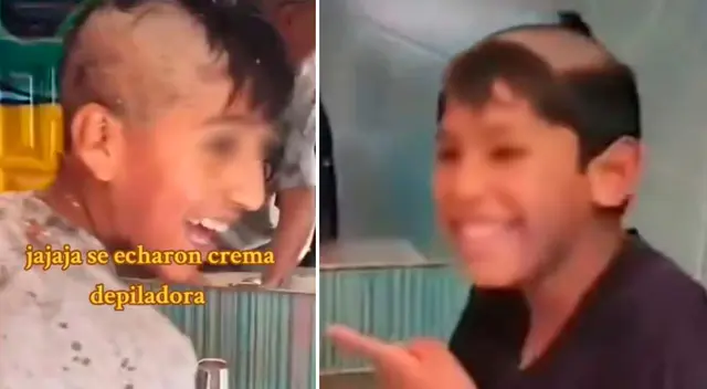 ¡TikTok Challenge Fail! Travesura infantil termina en calvicie temporal ¡TikTok Challenge Fail! Travesura infantil termina en calvicie temporal
