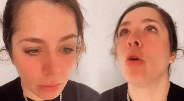 Yiddá Eslava sufrió una fuerte quemadura. Yiddá Eslava sufrió una fuerte quemadura.