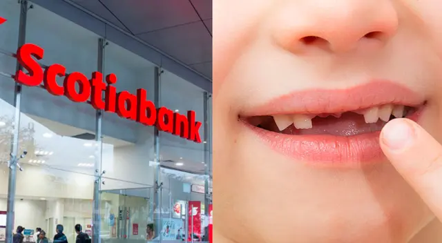 Scotiabank dará 100 soles a niños de entre 6 a 10 años de edad por la entrega de un diente de leche. Scotiabank dará 100 soles a niños de entre 6 a 10 años de edad por la entrega de un diente de leche.