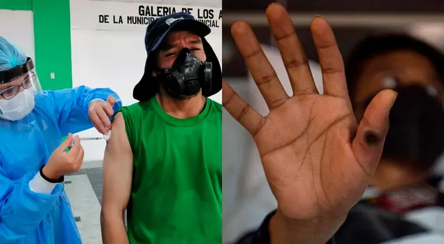 Conoce los detalles de la vacuna para la viruela del mono. Conoce los detalles de la vacuna para la viruela del mono.