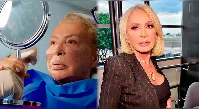 Laura Bozzo luce nuevo rostro.