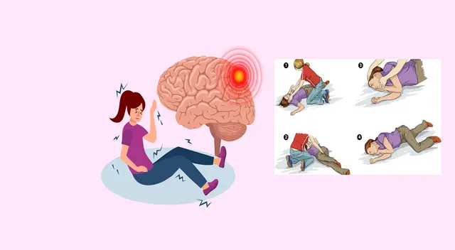 Mantén la calma y ayuda con cuidado a la persona con epilepsia.