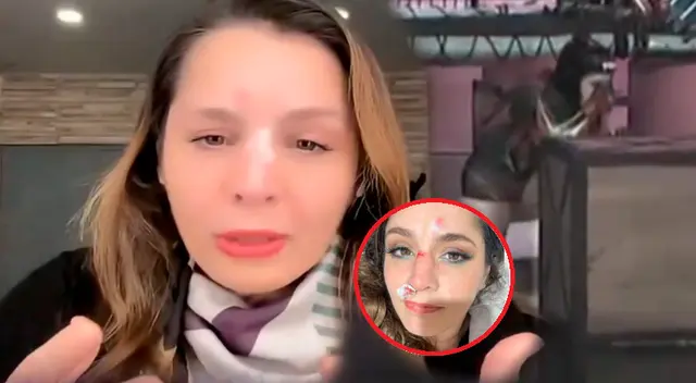 Yiddá Eslava aparece con la nariz fracturada en 'Esto Es Guerra'. Yiddá Eslava aparece con la nariz fracturada en 'Esto Es Guerra'.