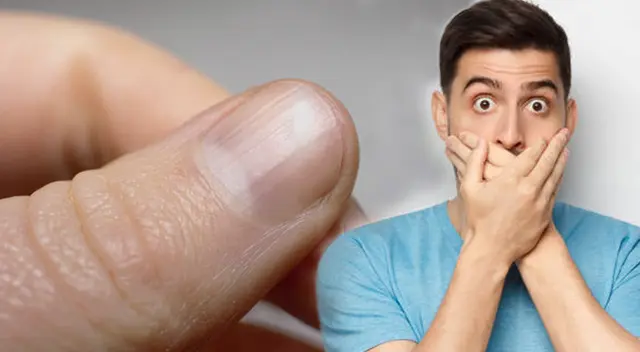 us uñas son un mapa de tu cuerpo, por eso, debes aprender a interpretar las rayas. us uñas son un mapa de tu cuerpo, por eso, debes aprender a interpretar las rayas.