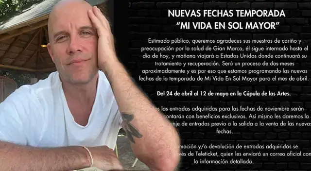 Gian Marco se irá a Estados Unidos por su problemas de salud.
