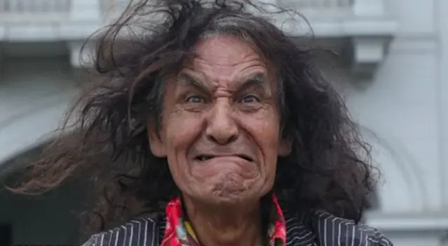 Mondonguito la pasa mal y pide ayuda para pagar su operación. Mondonguito la pasa mal y pide ayuda para pagar su operación.