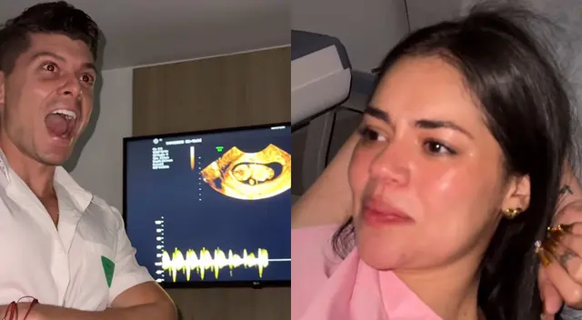 Ignacio Baladán y Natalia Segura fueron al doctor para ver ecografía de su bebé. Ignacio Baladán y Natalia Segura fueron al doctor para ver ecografía de su bebé.