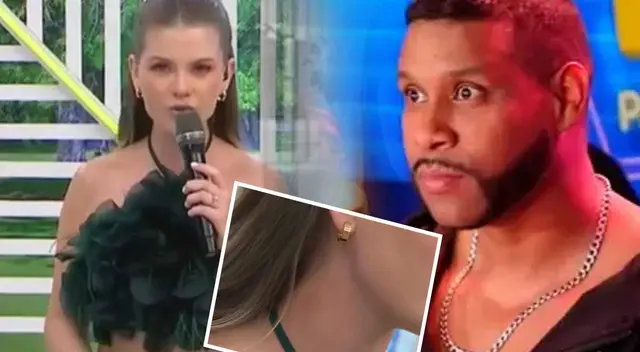 Brunella Horna aparece con mancha en el cuello en pleno programa y Giselo la 'echa'. Brunella Horna aparece con mancha en el cuello en pleno programa y Giselo la 'echa'.