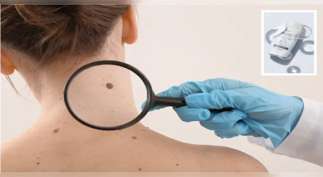 El uso del protector solar es fundamental estos días.