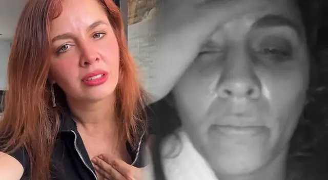 Yiddá Eslava sufre FUERTE accidente en pleno rodaje de película y termina con todo el rostro golpeado.