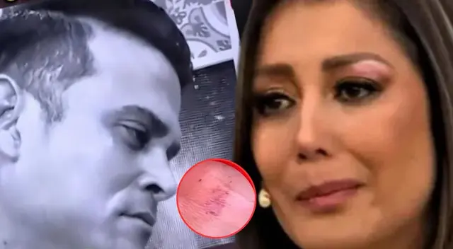 Christian Domínguez luce chupetón en el cuello y Karla Tarazona reacciona.