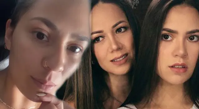 Gianella Marquina contó en sus redes sociales que sufre de melasma.