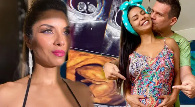 Stephany Orúe se encuentra a la espera de su primer bebé junto al ‘Chino’ Sabogal.