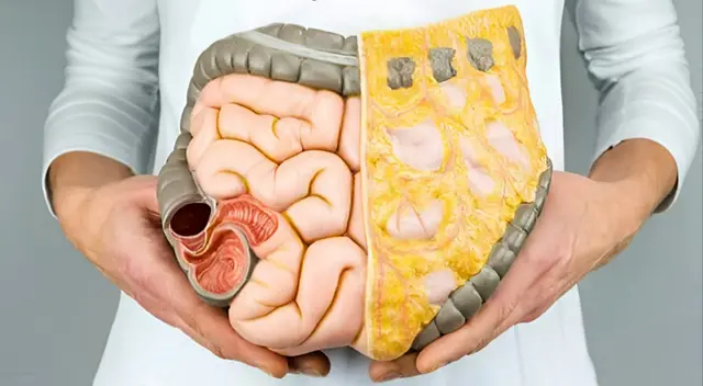 Descubre cómo detectar la grasa intraabdominal y por qué puede ser un riesgo para tu salud. Descubre cómo detectar la grasa intraabdominal y por qué puede ser un riesgo para tu salud.