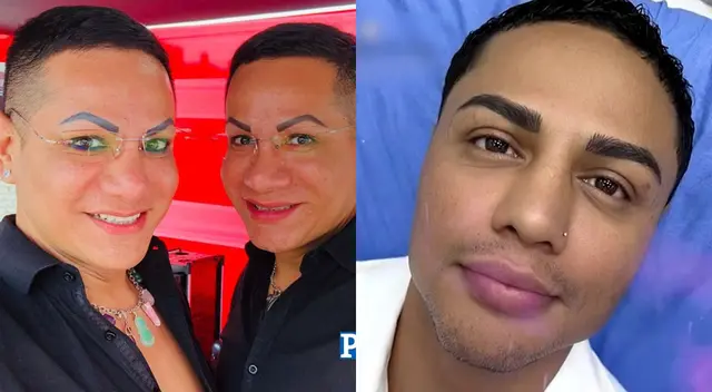Jonathan Maicelo se sometió a nuevos tratamientos estéticos.