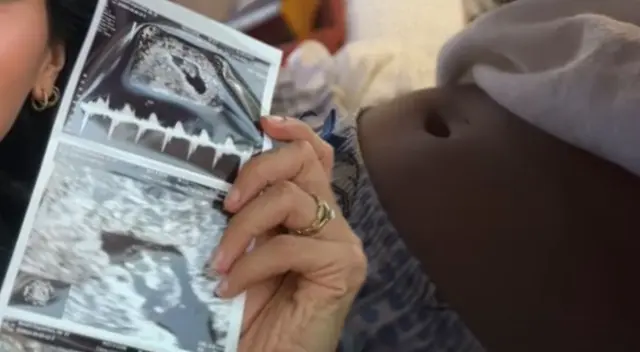 Ex chica reality revela que padece temida enfermedad. Ex chica reality revela que padece temida enfermedad.