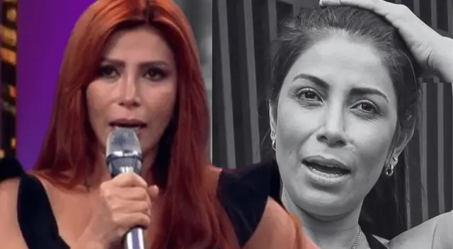 Milena Zárate confiesa que perdió la mitad de su nariz y tuvo que reconstruirla en 4 operaciones.