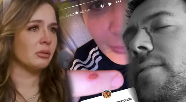 Yiddá Eslava aparece con CORTES y HERIDAS tras fuertes imágenes de Julián Zucchi ENSANGRENTADO tras visitar su casa.